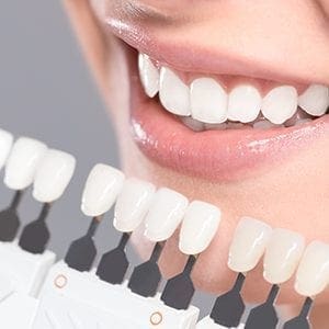 teeth-whitening